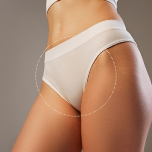 Brazilian (excl. rear)