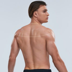 Shoulders